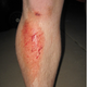 Illustration for article titled A Broken Thumb, Another Black Eye, And Our First Wiffle Ball Failure